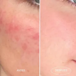 Desmaquillantes | Cremas Hidratantes<Mamita Botanical 1-007 Desmaquillante / Night Mask