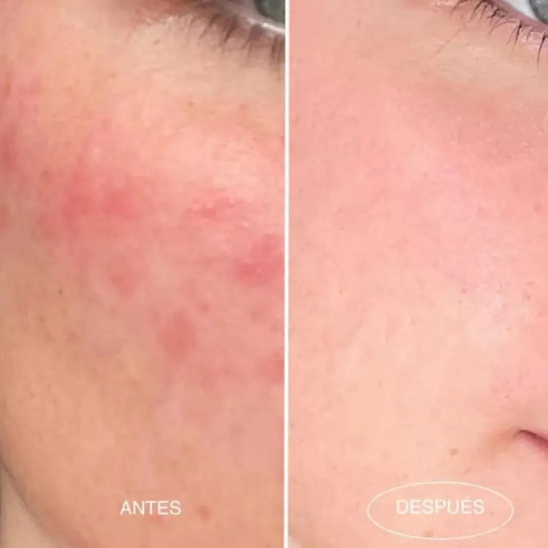 Desmaquillantes | Cremas Hidratantes<Mamita Botanical 1-007 Desmaquillante / Night Mask