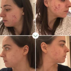 Sérums<Pai Skincare Instant Kalmer Serum